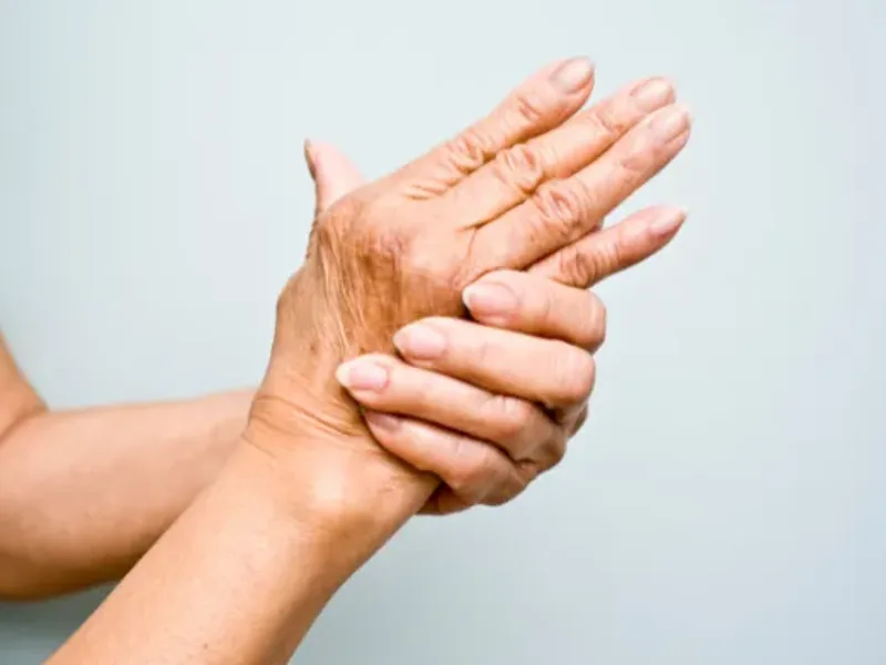 Arthritis treatment